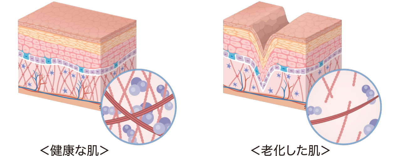 表皮のイメージ図