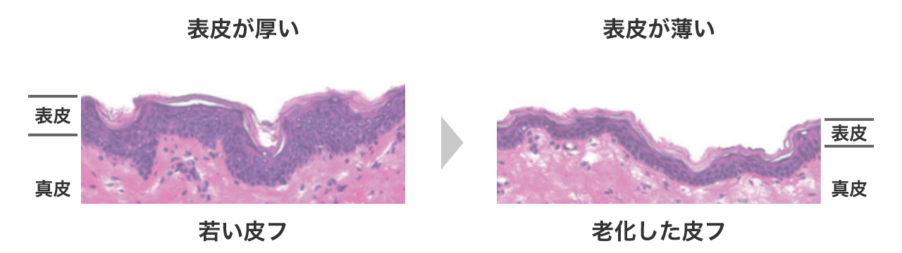表皮のイメージ図