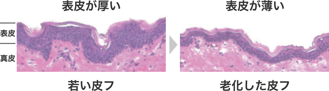 表皮のイメージ図