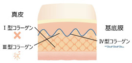 コラーゲン産生を促進イメージ