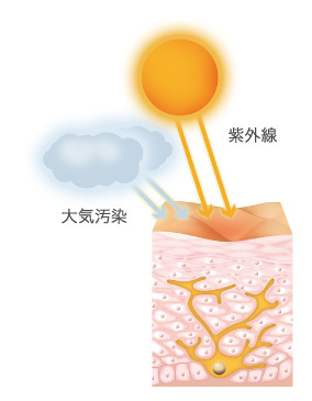 シミ・ソバカスができるメカニズム1