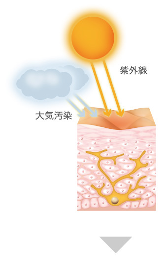 シミ・ソバカスができるメカニズム1