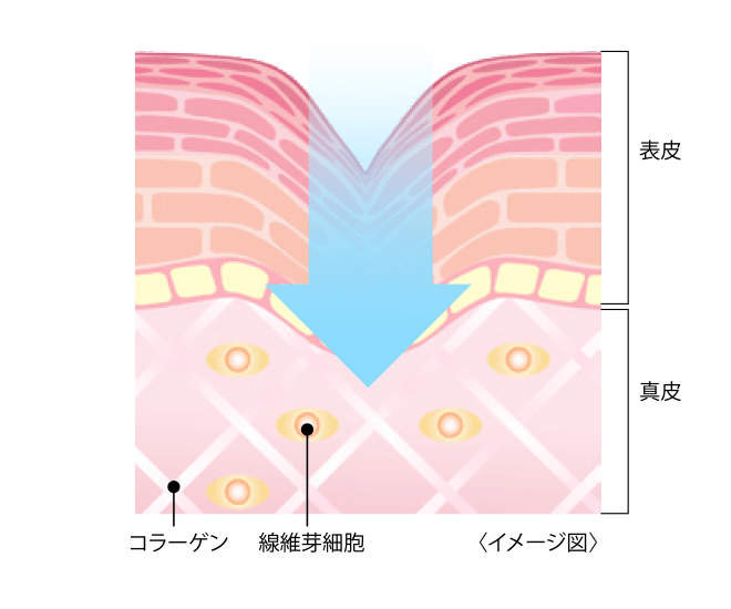 皮膚のイメージ