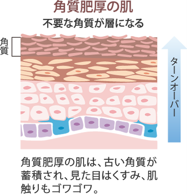 角質肥厚の肌