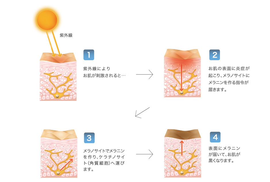 シミができるメカニズム